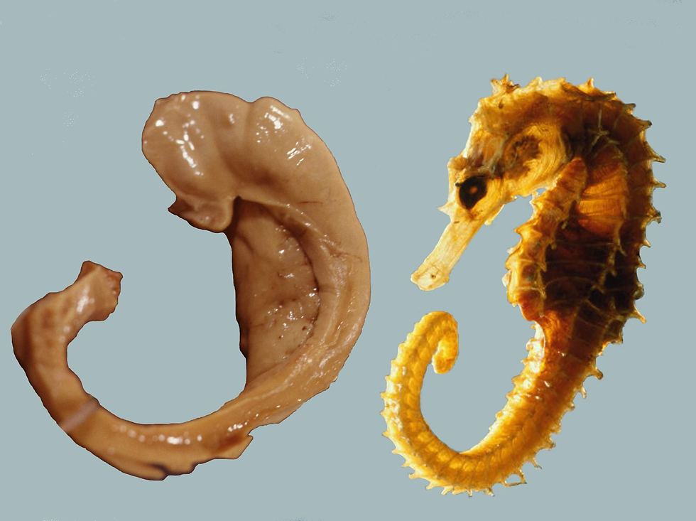 Prof. Laszlo Seress' anatomische Präparation eines menschlichen Hippocampus neben einem Seepferdchen. (1980) **