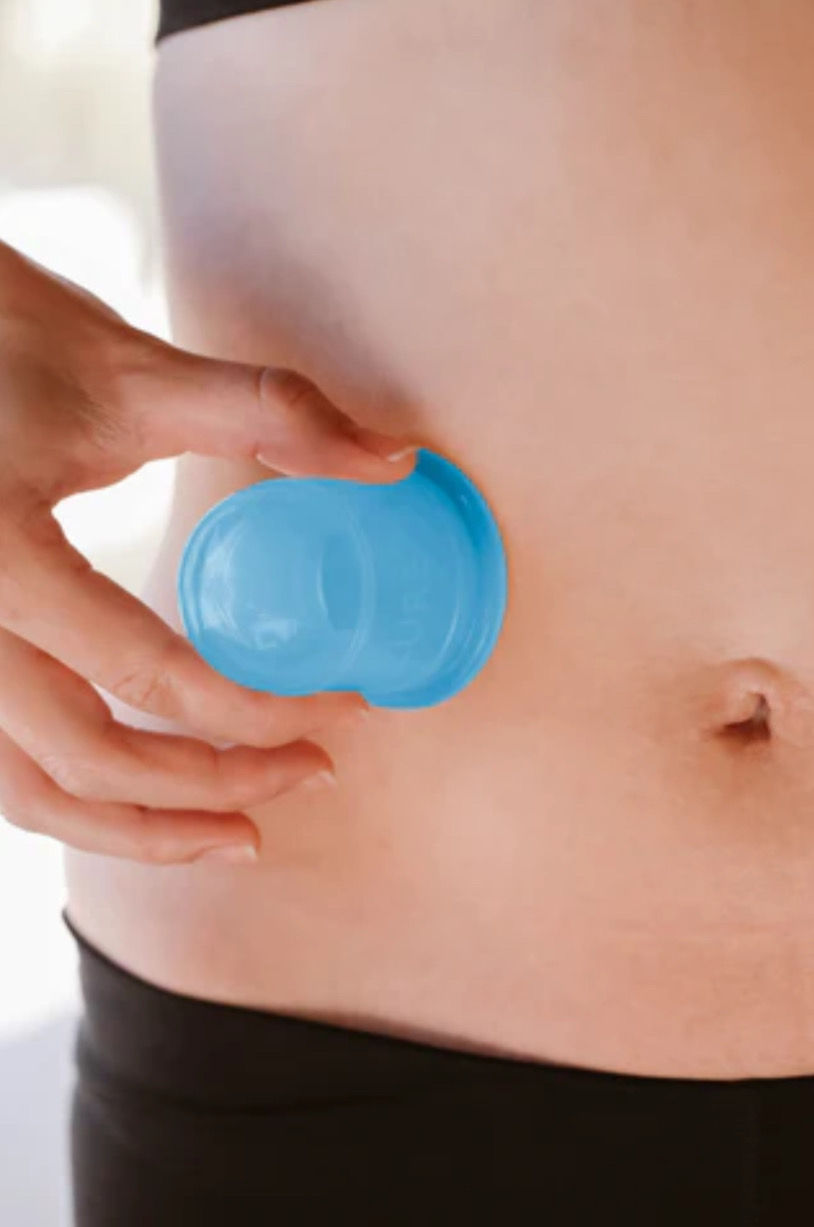 cupping
