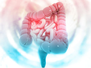 Prevenção do câncer de intestino grosso