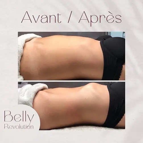 avant et après du massage