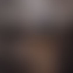 Types of Shoulder Injuries Due To Rock Climbing