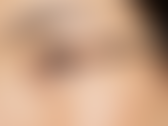 How the safety of prostaglandin analogues (PGAs) shapes the regulatory landscape in Europe