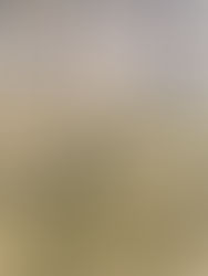 Why Rhizophora-Dominated Mangrove Plantations May Not Save Our Coasts