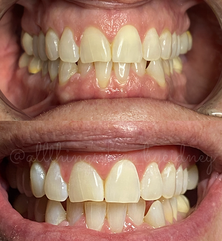 image0(4).png