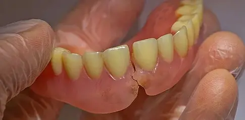 Dentures