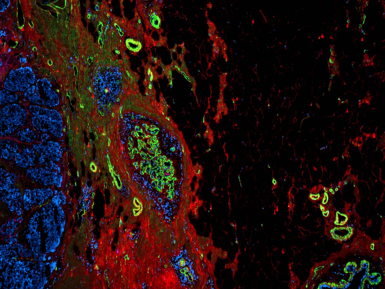 Research munsonlabatVT