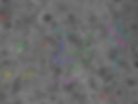 Tracked glioma cells in 3D