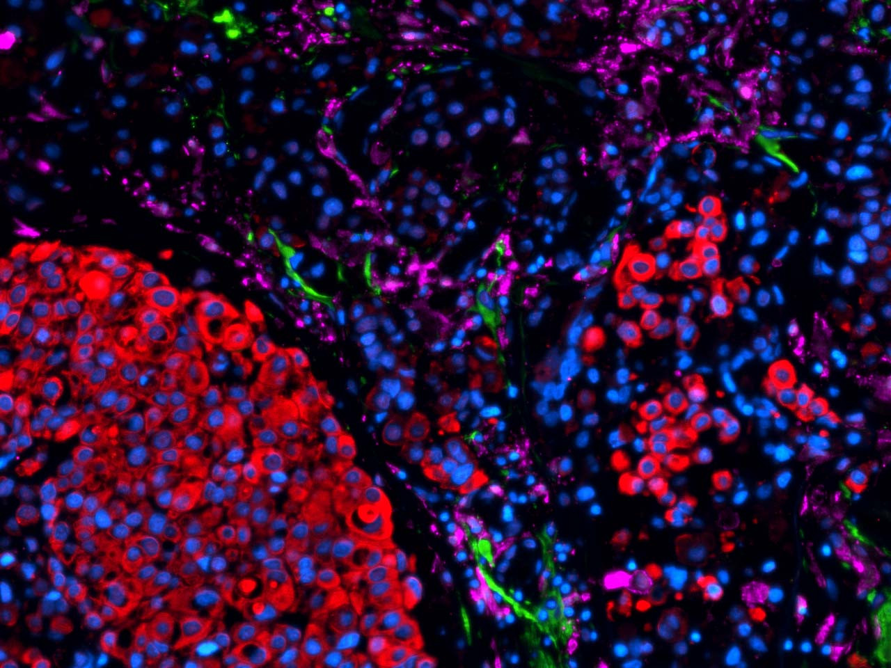 Munson Lab for Oncoengineering