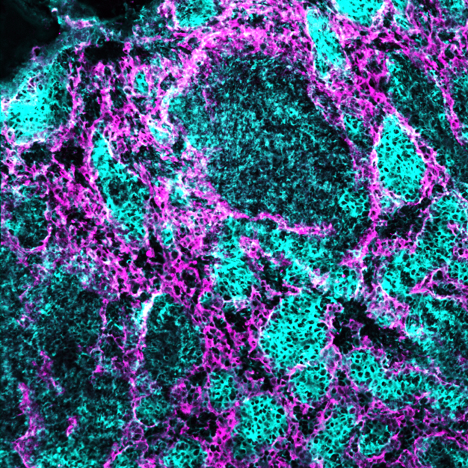 Research munsonlabatVT