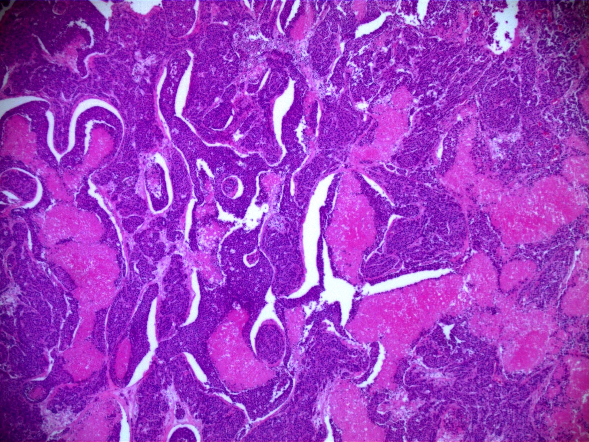 Research munsonlabatVT