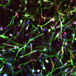 Fibroblasts.jpg
