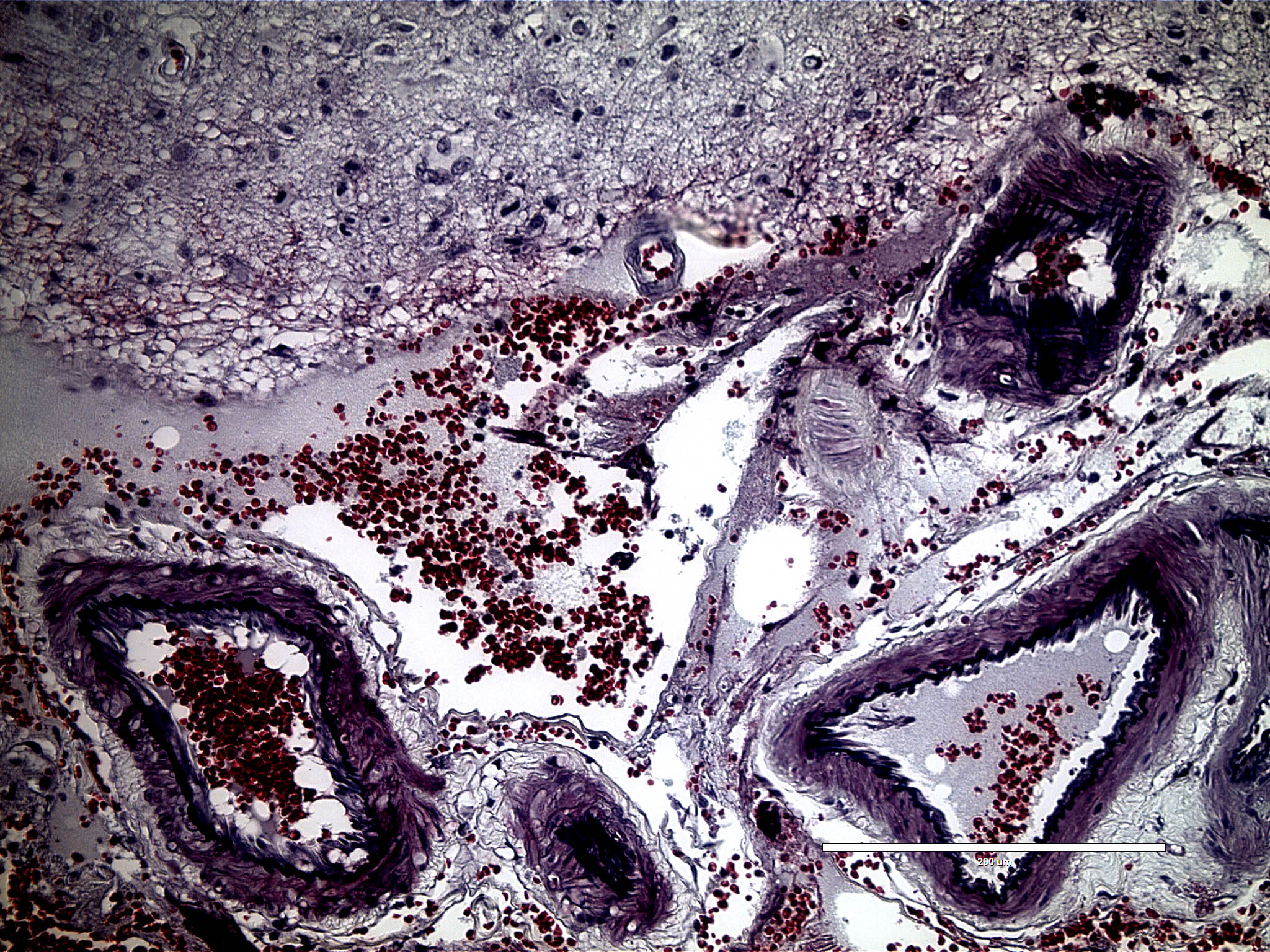 Research munsonlabatVT