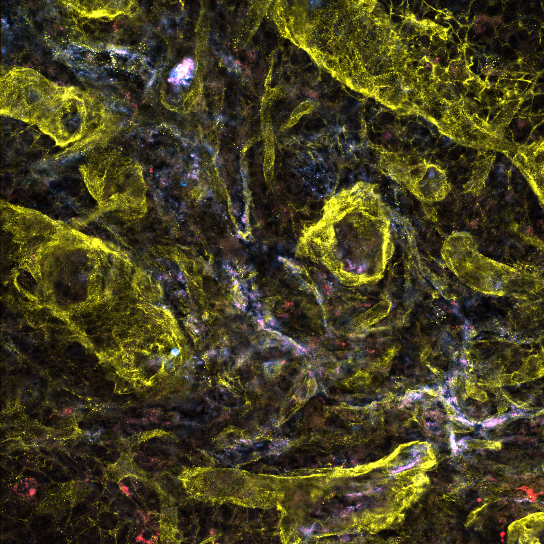 Research munsonlabatVT