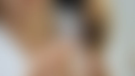 Queda de cabelo feminina pode ser temporária, mas exige avaliação dermatológica para diagnóstico correto