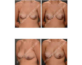 For Website (3).png