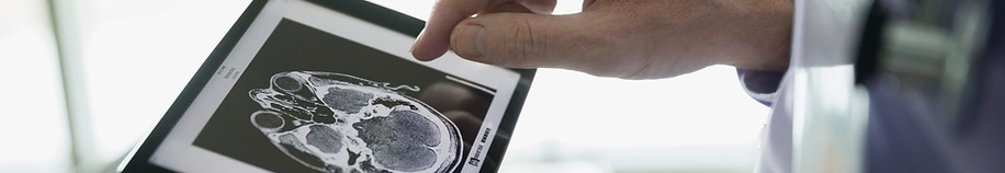 Doctor que examina la exploración del CT