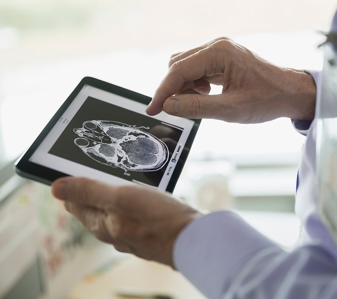Doctor que examina la exploración del CT