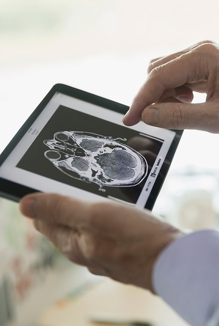 Doctor Examining CT Scan