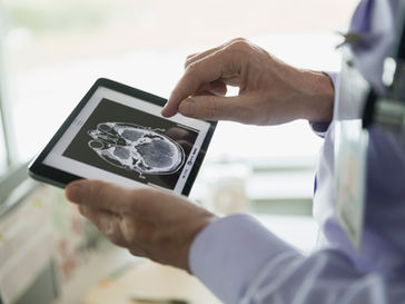 Image d'un médecin qui regarde la radio d'un crâne pour évoquer la migraine chronique
