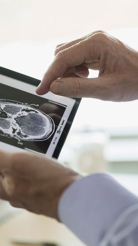 Doctor Examining CT Scan