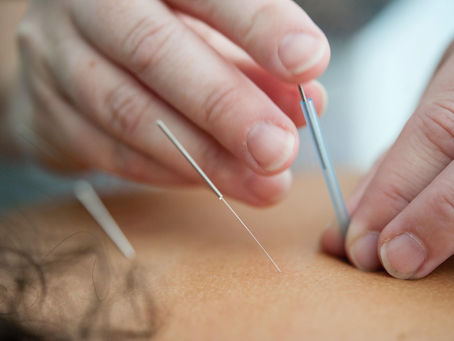How Does Acupuncture Work?