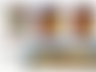 Enhancing Facial Contours: Fat Grafting for Temporal Region and Midface