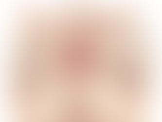 3 Emerging Trends in Non-surgical Aesthetic Gynaecology