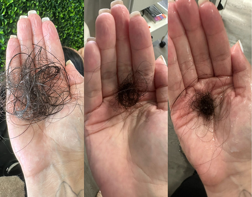 Hair Loss Treatment in Brisbane: What Really Works and Why Integrative Trichology Matters