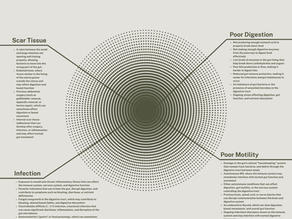 Diagram showing the many factors that can influence digestive health including digestion, microbiome balance, gut motility, infections, immune function, hormones, stress and previous surgeries.