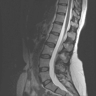 Spine, Dr. Mark Fishman