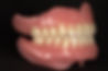 Complete Mouth Dentures SideShow.CR2