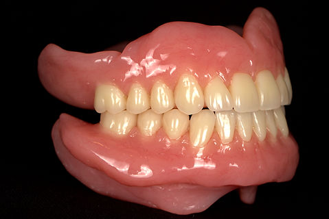 Complete Mouth Dentures SideShow_edited.