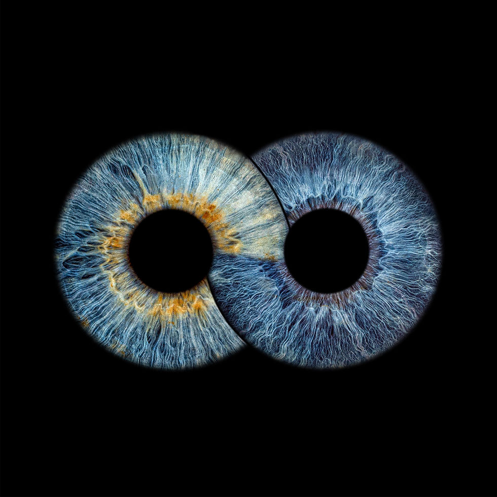 Miniaturbild: Iris-Shooting & 1x Aluminiumbild