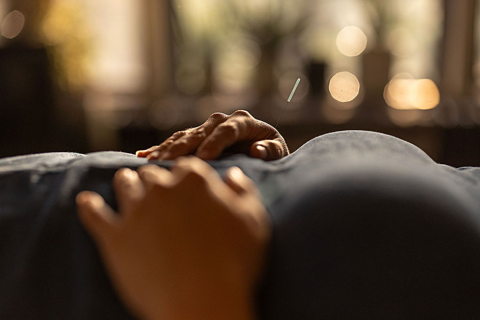 hands of someone getting acupuncture