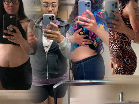 It's My Surgiversary> 1 yr post op RNY with Hiatal Hernia Repair, Thanks to Dr. Elias Ortiz 