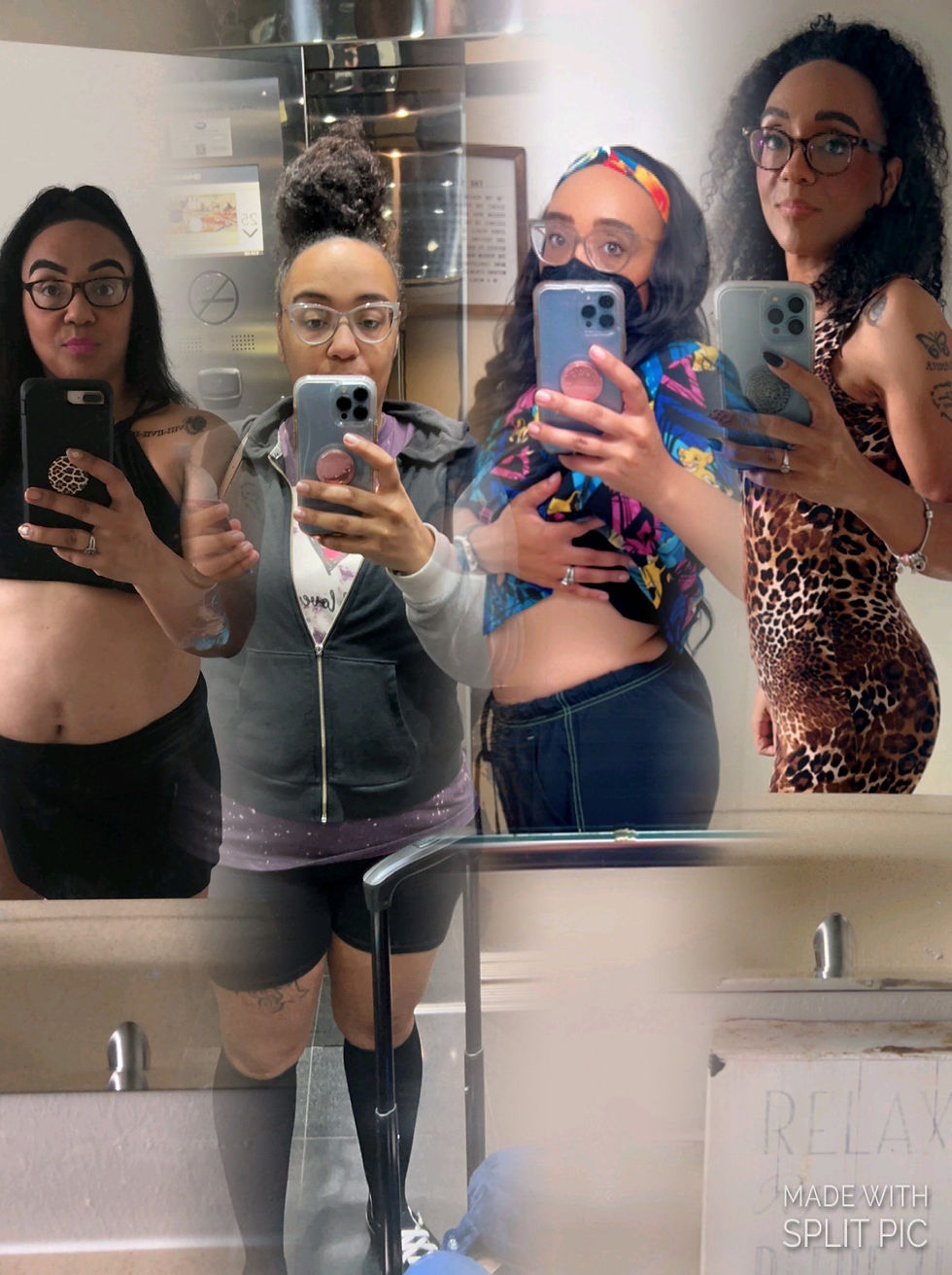 Picture includes, prep, day of surgery, midway point and current pic