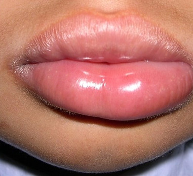 WolffAllergist48202.jpg