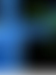 9 Things To Eat To Increase Your Immune Power