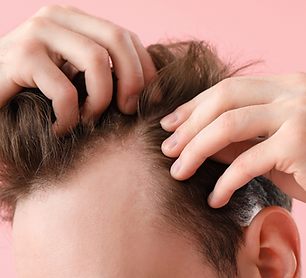 Haartransplantation