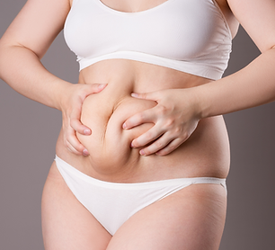Lipoabdominoplastik