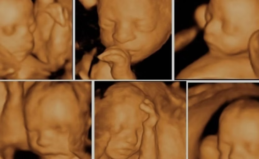 Obstetrik Görüntüleme
