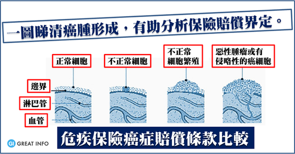 危疾保險: 邊間癌症賠償界線比較貼近醫學界定?