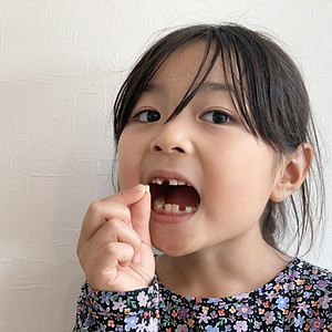 子供の仮歯・義歯
