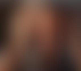 Brain Inflammation & You: Protect Your Memory