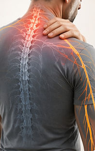 Neck pain