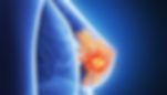 Resonancia Magnética Marbella