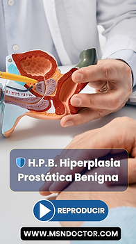 Próstata Agrandada: Hiperplasia Prostática Benigna (H.P.B.), MSN Doctor