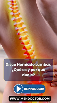 Disco Herniado Lumbar: