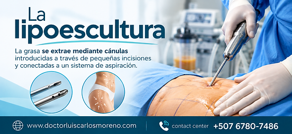 Lipoescultura
