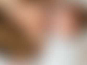 LESIONES EN EL POSTPARTO